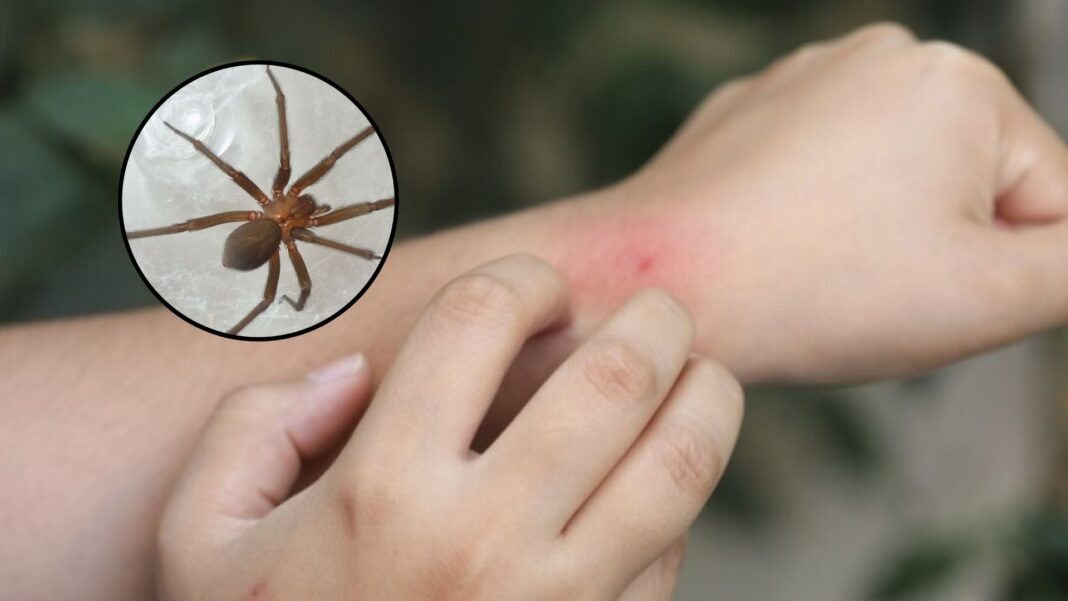 Alerta en invierno: aumentan las mordeduras por araña casera y podrían ser mortales. Foto: Composición R365.