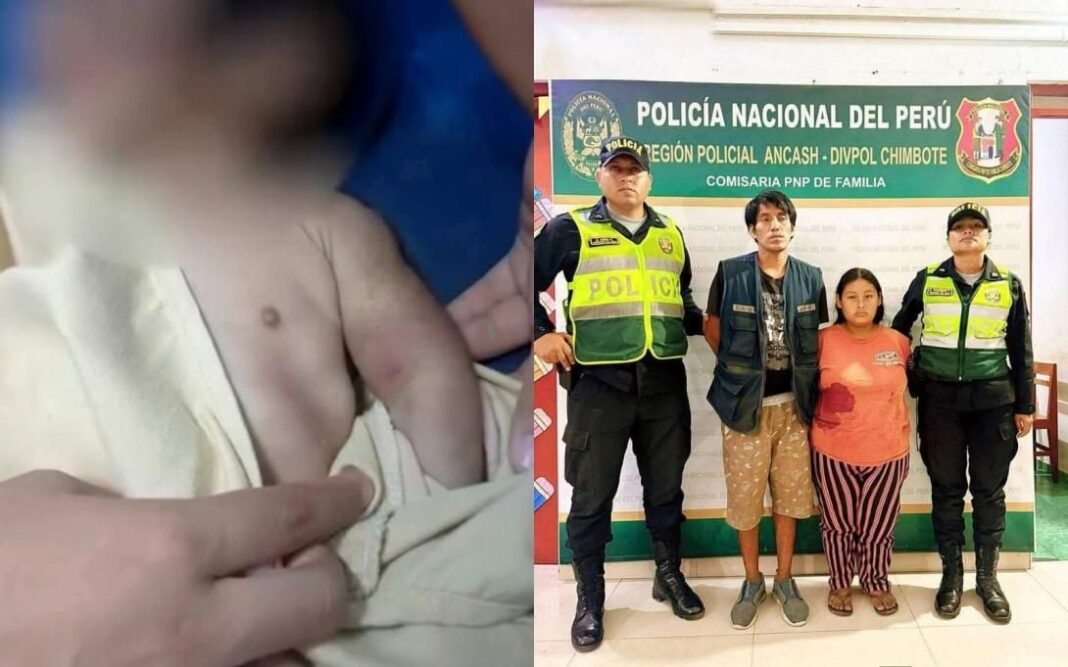 Chimbote: bebé de un mes sufre fracturas graves tras presunto maltrato de sus padres.