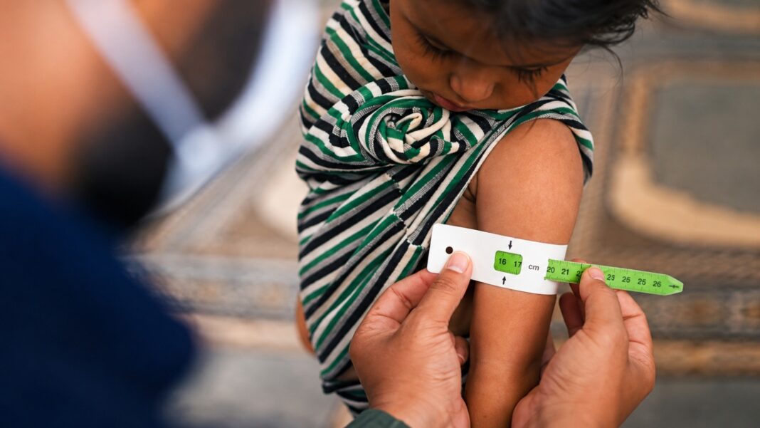 Desnutrición crónica infantil afecta al 15% de los niños menores de cinco años en Piura. Foto: Difusión.